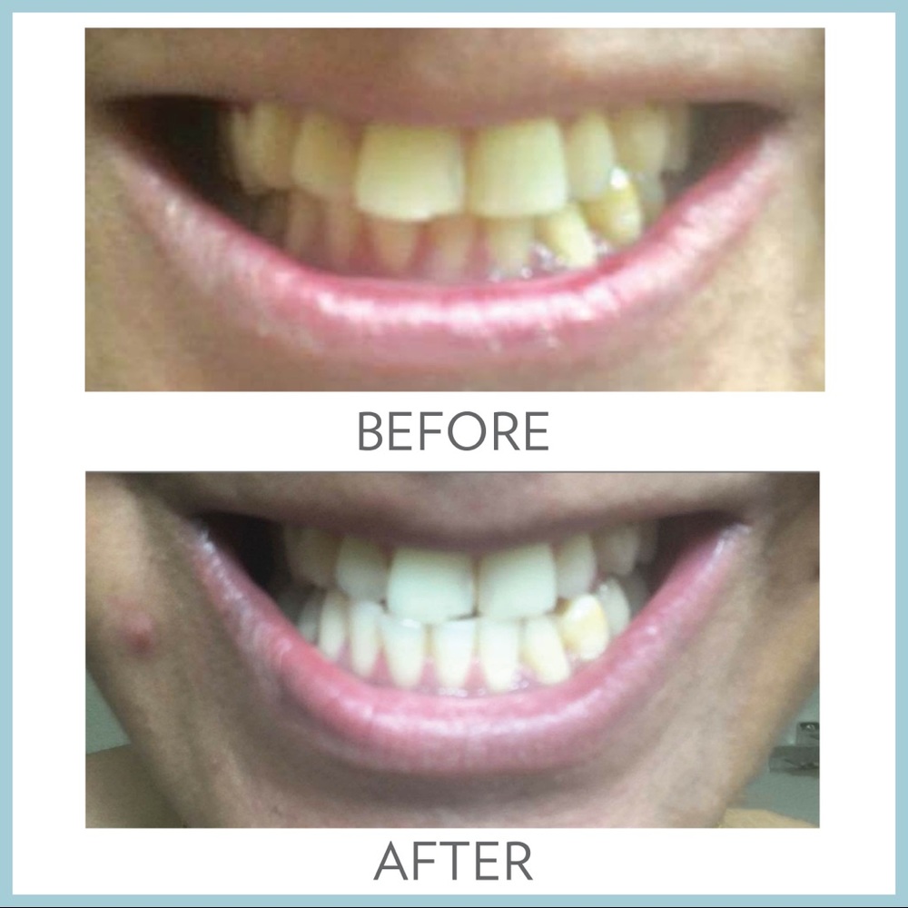 4 pack - NuSkin AP24 Whitening Toothpaste - Picture 3 of 4